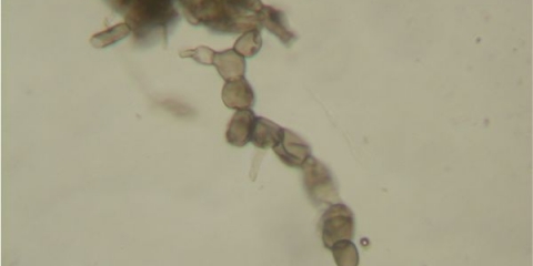 Zašto jabuke trunu na drvetu i šta učiniti?